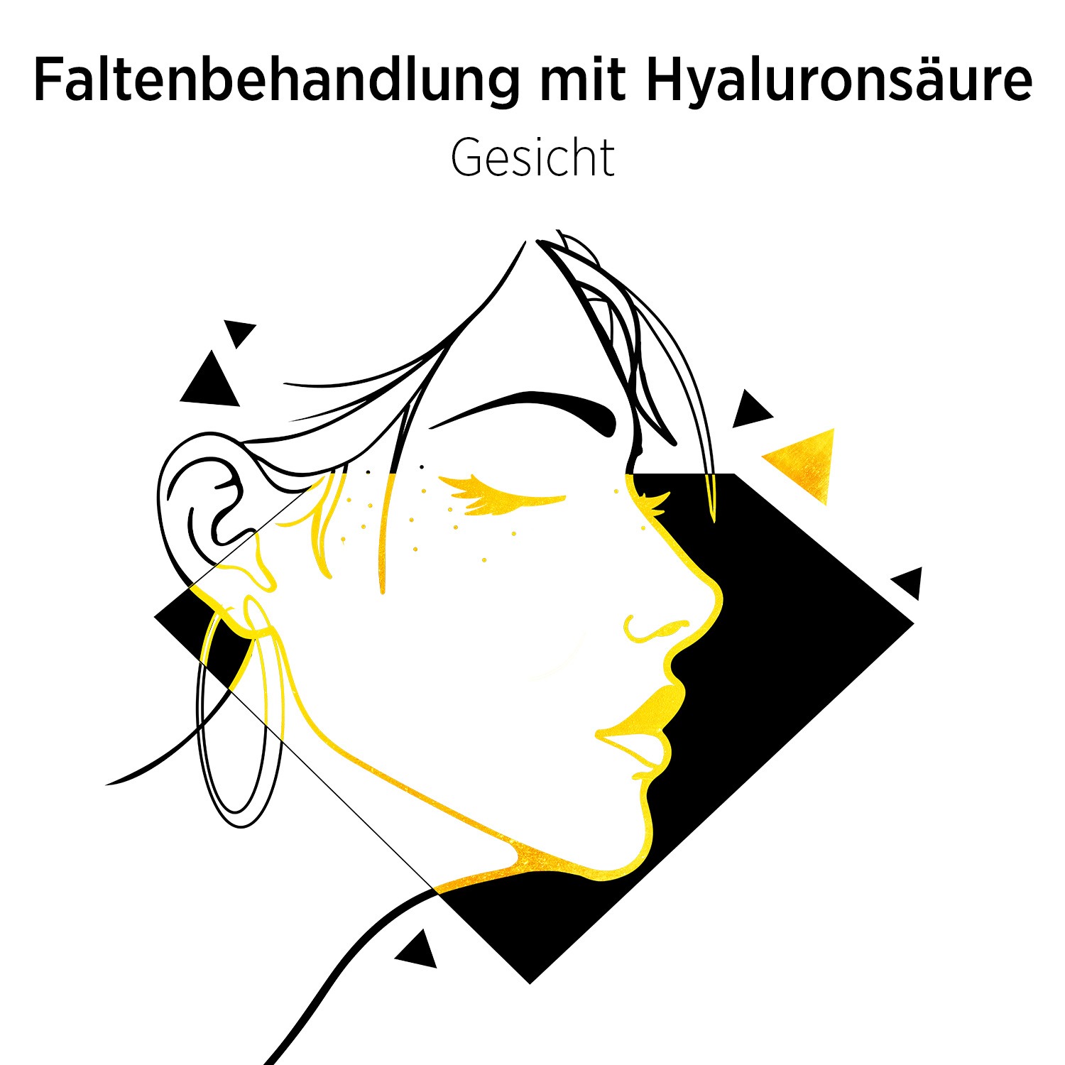 Faltenbehandlung mit Hyaluronsaure Aesthetic Dream - WEB