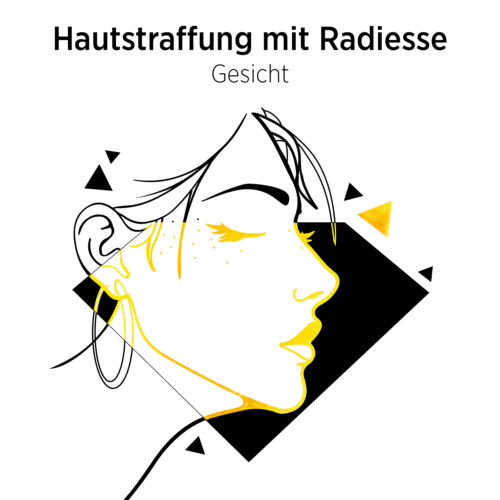 Hautstraffung mit Radiesse Aesthtetic Dream - Leistung Gesicht